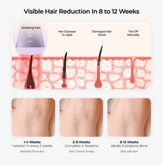 Sapphire Fast Flash Smart IPL Device